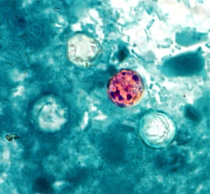 USDA сворачивает исследования Cyclospora на фоне 30 000 случаев заражения