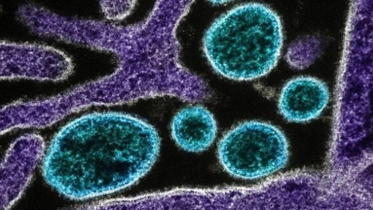 В Стэнфорде с помощью ИИ созданы 16 новых вирусов против E. coli