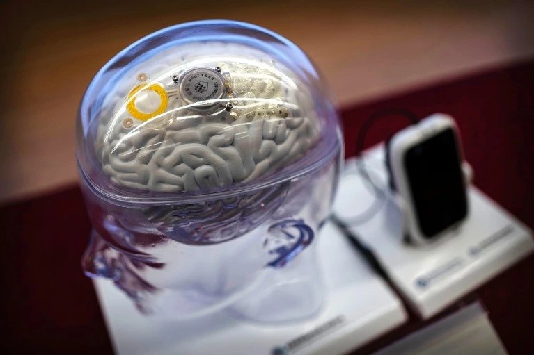 Brain implant translates speech and gestures in real time